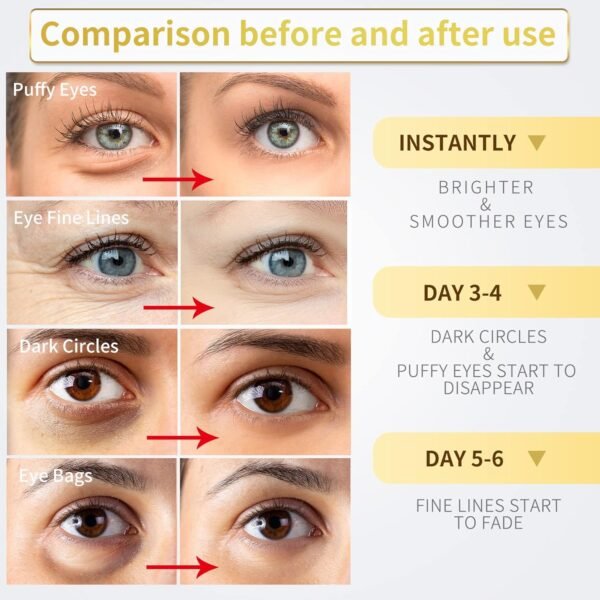 Under Eye Patches - 60 Pcs - 24K Gold Eye Mask- Puffy Eyes & Dark Circles Treatments,Reduce Under Eye Bags and Smooth Wrinkles,Eye Skin Care Pads With Collagen,Hyaluronic Acid & Castor Oil - Image 3