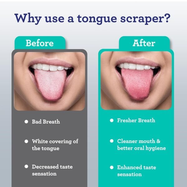 GuruNanda Tongue Scraper for Adults (2 Pack) with Travel Case, 420 Medical-Grade 100% Stainless Steel Tongue Cleaner, Aids in Fresh Breath & Oral Care - Image 4
