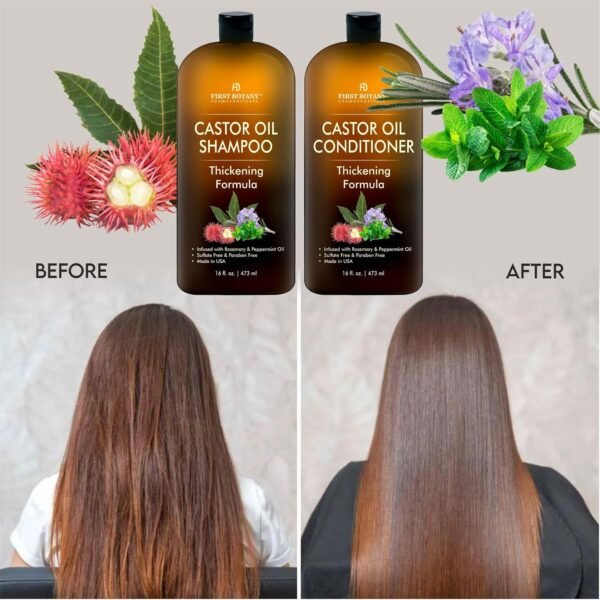 Castor Oil Shampoo and Conditioner - An Anti Hair Loss Set Thickening formula For Hair Regrowth, Anti Thinning Sulfate Free For Men & Women Anti Dandruff Treatment - 16 oz - Image 2